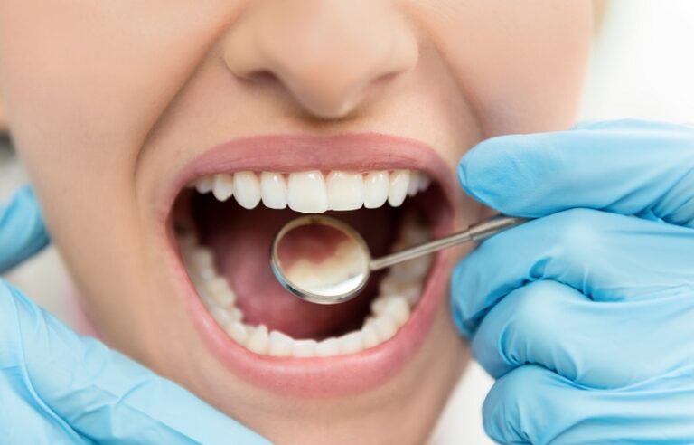 Dental Restoration