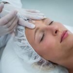 Botox injections
